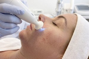 Terapia plazmowo-jonowa w kosmetologii